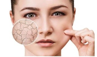 Batana oil Batana oil